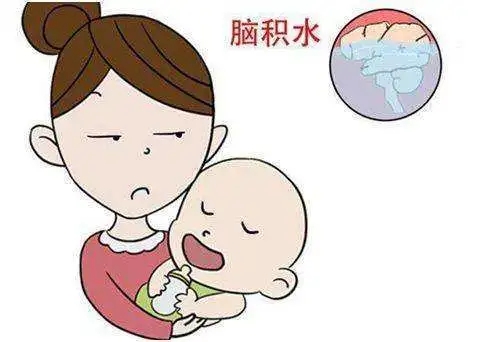 宝宝脑积水有哪些症状？宝宝脑积水的症状